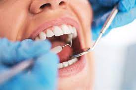 Transfert de charge des soins dentaires à l&rsquo;AMC – Les adhérents pourraient « serrer les dents » dès l&rsquo;an prochain
